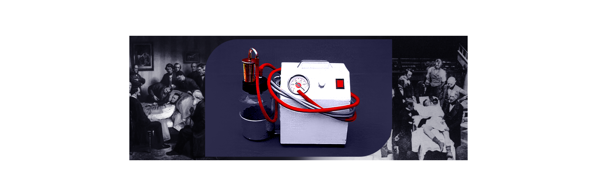  The Silent Partner in Saving Lives: A Historical Journey of Surgical Suction Units
